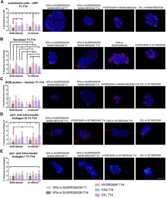 Long-term cultures of human pancreatic islets in self-assembling peptides hydrogels